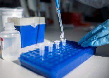 Κρούσματα σήμερα: 1.607 νέα ανακοίνωσε ο ΕΟΔΥ – 78 θάνατοι σε 24 ώρες, στους 847 οι διασωληνωμένοι