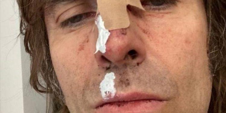 Ο Liam Gallagher έπεσε από ελικτόπτερο