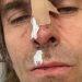 Ο Liam Gallagher έπεσε από ελικτόπτερο