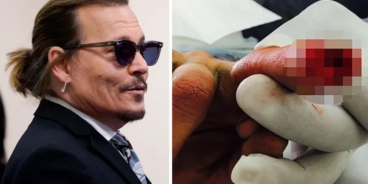 Τζόνι Ντεπ – Άμπερ Χερντ: Νοσοκόμα έψαχνε μέσα σε ένα διαλυμένο σπίτι το κομμένο δάχτυλο του ηθοποιού