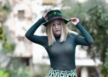 Ιωάννα Παλιοσπύρου: Έβγαλε τη μάσκα και δείχνει το πρόσωπό της για πρώτη φορά μετά την επίθεση