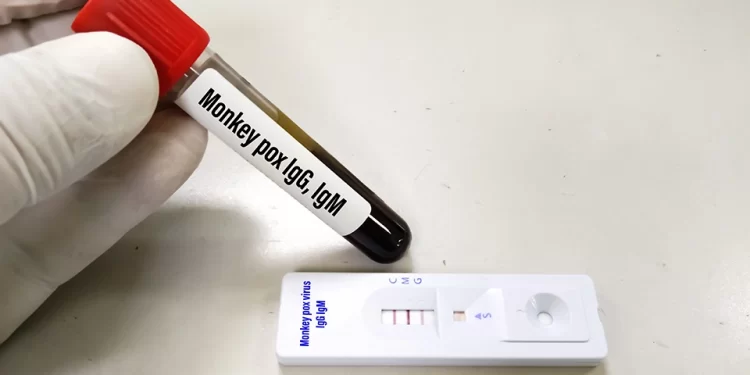 «Αρχόμενη επιδημία» η ευλογιά των πιθήκων – Τι λένε ειδικοί