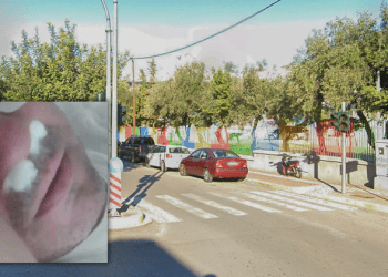 «Με χτύπησε ο γονέας του παιδιού που ασκούσε bullying στο δικό μου»-Τι λέει το θύμα επίθεσης