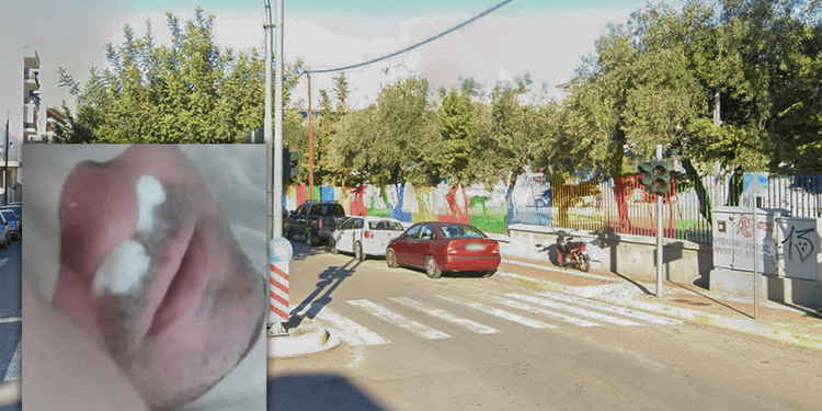 «Με χτύπησε ο γονέας του παιδιού που ασκούσε bullying στο δικό μου»-Τι λέει το θύμα επίθεσης