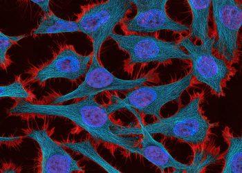 Οι σημαντικότερες εξελίξεις που περιμένουμε στην αντιμετώπιση του καρκίνου το 2024