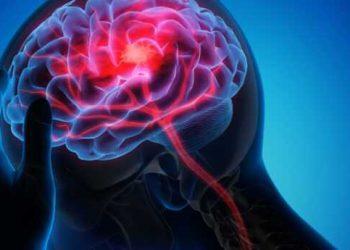 Οι νευρολογικές παθήσεις επηρεάζουν το 43% του παγκόσμιου πληθυσμού