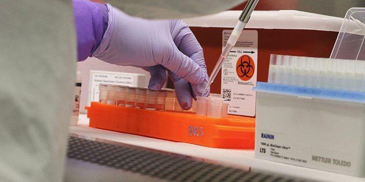 Στιγμιότυπο από μικροβιολογικό εργαστήριο. Φωτογραφία αρχείου: AP Photo/Audrey McAvoy