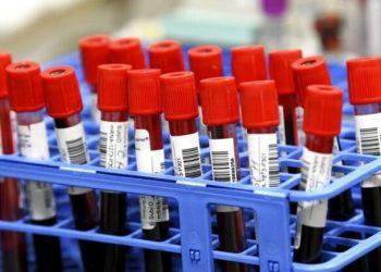 Επιστήμονες ανακαλύπτουν πρωτεΐνες του αίματος που μπορούν να προειδοποιήσουν για καρκίνο χρόνια πριν από τη διάγνωση