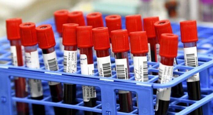 Επιστήμονες ανακαλύπτουν πρωτεΐνες του αίματος που μπορούν να προειδοποιήσουν για καρκίνο χρόνια πριν από τη διάγνωση