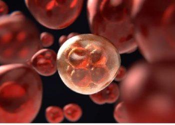 λιπώδες ήπαρ