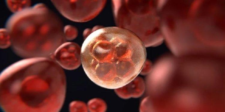 λιπώδες ήπαρ