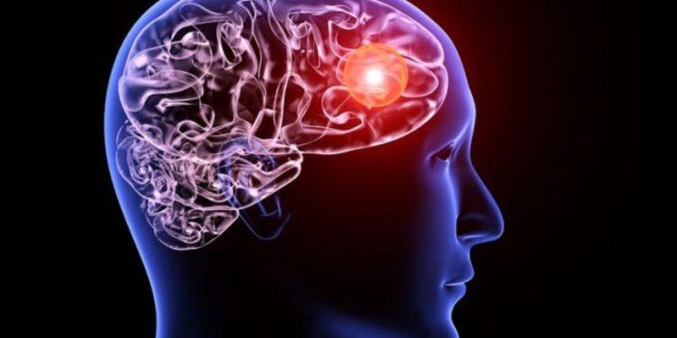 Πώς συνδέεται το εγκεφαλικό με την υπερβολική κατανάλωση καφέ και αναψυκτικών